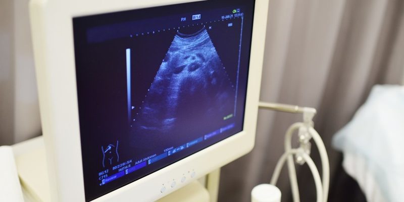 Bezpieczeństwo USG podczas ciąży: Czy badanie ultrasonograficzne jest bezpieczne dla rozwijającego się płodu?